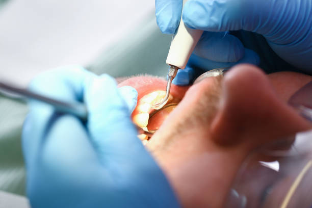 Best Emergency Treatment for Toothache in New Port Richey East, FL