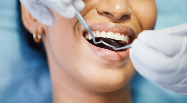 Best Emergency Wisdom Teeth Removal in New Port Richey East, FL