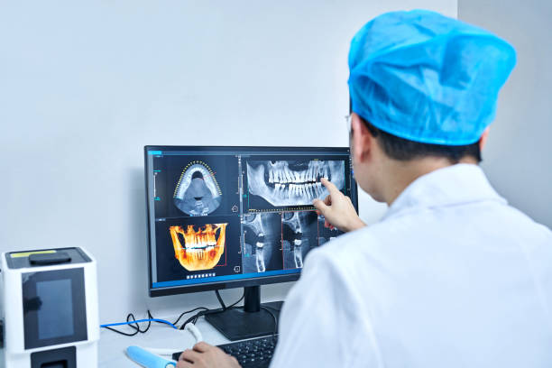Best Emergency Wisdom Teeth Removal in New Port Richey East, FL